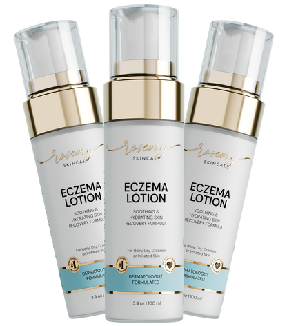 Rosevry | Hydrating Care Eczema Lotion