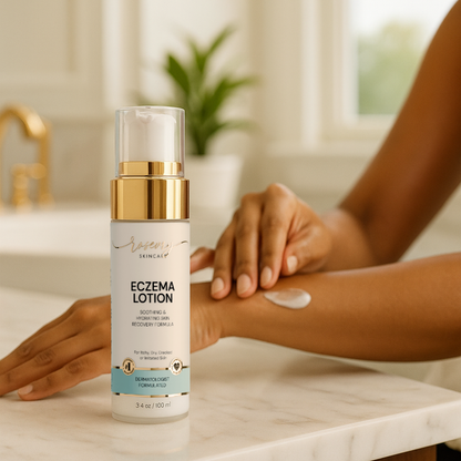 Rosevry | Hydrating Care Eczema Lotion